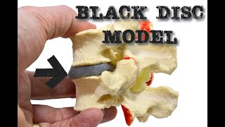 Black Disc Model by Dynamic Disc Designs [upl. by Benton]