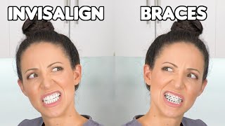 Braces or Invisalign Which is BETTER [upl. by Amlev935]