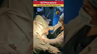 IUI Procedure  intrauterine insemination procedure  by Dr Rakshita Malik ivfcenter iuitreatment [upl. by Tema187]