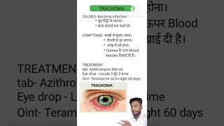 Trachoma treatment [upl. by Gildus]