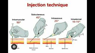 Injection Techniques quotIntermuscular Subcutaneous Intravenous Intradermalquot [upl. by Haslett358]