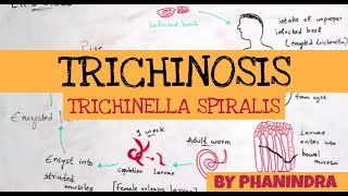 TRICHINOSIS  TRICHINELLA SPIRALIS  STRUCTURE  LIFE CYCLE  SYMPTOMS  BY PHANINDRA GUPTA [upl. by Eberly435]