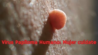 VIRUS PAPILOMA HUMANO CUÍDATE MUJER [upl. by Adlih]