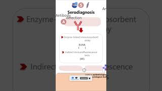 SerodiagnosisGiardia lamblia parasitology microbiology pathology diagnosis neetpg neet [upl. by Newmann378]