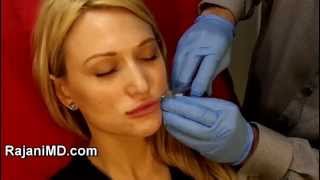 Voluma Microcannula Lip AugmentationRajani Portland [upl. by Marcellina]