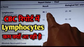 Low Lymphocytes In blood Test Lymphocytes Low In Blood Test Lymphocytes In Hindi cbc blood test [upl. by Matthews]