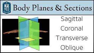 EASY TRICKS for Anatomical Body Planes and Sections DirectionPosition [upl. by Otero786]