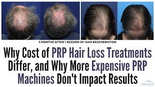 Factors of Differing Costs of PRP Hair Loss Treatments and Why Expensive PRP Machines are Unproven [upl. by Renraw]