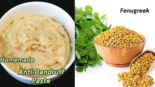 How to Get Rid of Dandruff  Homemade Natural Treatment  Miracle Cure For Dandruff [upl. by Mackie313]