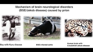 Mechanism of brain neurological disorders BSEJakob disease caused by prion proteins [upl. by Beaver369]