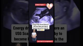 Hyperactive baby in energy drink see pregnancy ultrasound🥰🥰viralvideo trending baby [upl. by Analaj]