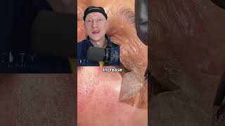 Chemical Peel Skin PEELING  Plastic Surgeon Reacts [upl. by Hamehseer]