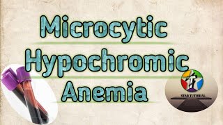 Microcytic Hypochromic Anemia in hindi ll ANEMIA ll Hematology And Blood Banking [upl. by Idnal834]