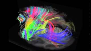 Konnektom und Hirnentwicklung geometrisch verwebte Nervenfasern [upl. by Lerrud]