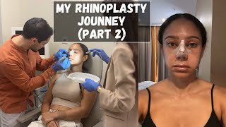 My RHINOPLASTY JOURNEY amp SEMI REVEAL Part 2  Tiana Peri [upl. by Ilsa]