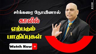 சர்க்கரை நோயினால் ஏற்படும் பாதிப்புகள் Dr jeyakumar Explain  Diabetic  Plastic Surgery  Foot [upl. by Dex480]