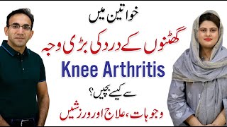 Knee Arthritis Exercises  Knee Pain Causes amp Treatment  Dr Irfan Ahmed Physiotherapist [upl. by Lemahs204]