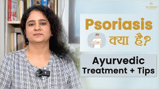 Psoriasis Ayurvedic Treatment  Best Tips for Psoriasis  Home Remedies for Psoriasis [upl. by Ardnazxela]