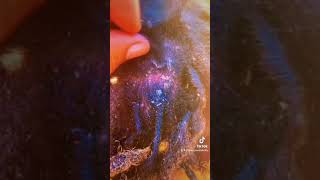 DANDRUFF FLAKES everywhere youtubeshorts trending dandruff psoriasis follow reels tiktok [upl. by Iror920]