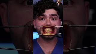 Gold teeth with golden toothpaste 🦷 yt viral ytshorts argal [upl. by Eirrek623]