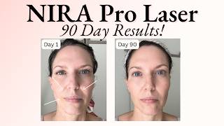 90 Day Results Using NIRA Pro Laser  Before amp After Photos  Fine Lines Wrinkles amp Build Collagen [upl. by Esil990]