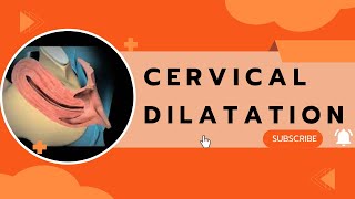 Cervical Dilatation [upl. by Asalocin536]