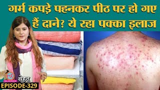 Back Acne यानी पीठ कंधों पर निकलने वाले दानों को कैसे ठीक करें  Sehat ep 329 [upl. by Lleynod]