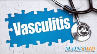 Vasculitis ¦ Treatment and Symptoms [upl. by Oratnek]