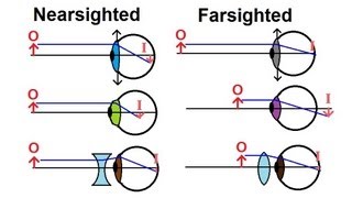 Physics  Optics Vision Correction 1 of 5 Introduction [upl. by Drhacir]