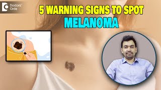 5 Warning Signs of MelanomaMelanoma amp Skin Cancer Awareness MonthDrRajdeep MysoreDoctors Circle [upl. by Nylirahs345]