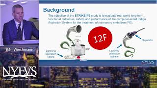 Indigo Thrombectomy Bret N Wiechmann Venous Symposium [upl. by Otinauj]