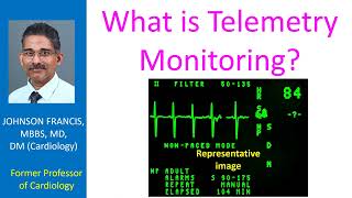 What is Telemetry Monitoring [upl. by Olympia956]