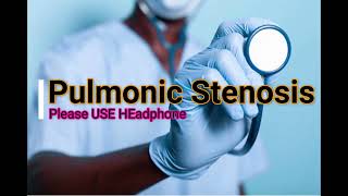 Pulmonic Stenosis Sound Heart Sounds  Cardiology [upl. by Julide]