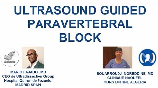 Paravertebral Block Ultrasound Guided PVB [upl. by Eul586]