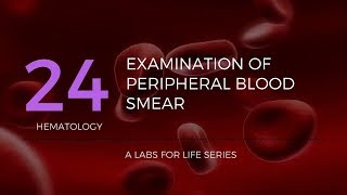 Part 2  Examination of Peripheral Blood Smear [upl. by Harod]