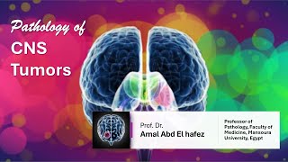 CNS Brain TumorsNeoplasms شرح محاضرة [upl. by Llehsem]