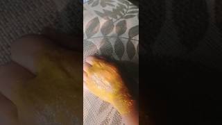 Pigmentation treatment for hometips diy skincare diyfacemask shortsviral [upl. by Alburg]