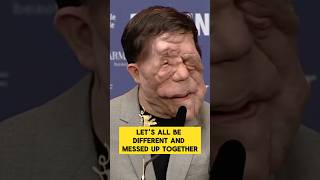 Adam Pearson on embracing differences rather than fearing them Berlin Film Festival [upl. by Sturges612]