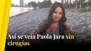 Así se veía Paola Jara sin cirugías [upl. by Airdnaxila]