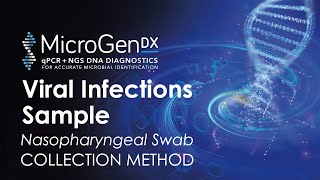 Viral Infections Sample Collection Method Using Nasopharyngeal Swab [upl. by Eceeryt493]