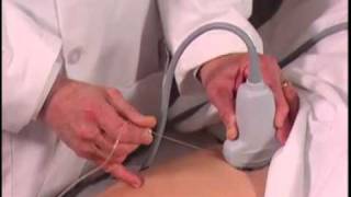 Ultrasound Guided Hip Injection SonoSite [upl. by Zeni961]