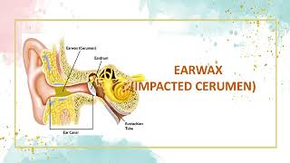 Impacted cerumen Definition of impacted cerumen  Causes of impacted cerumen Symptoms✨ [upl. by Dav]