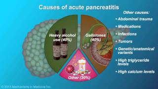 Acute Pancreatitis [upl. by Eatnahc]