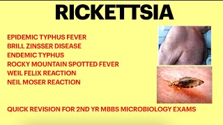 Rickettsia  Microbiology  Typhus fever  Weil felix test Rickettsial infection [upl. by Cosetta]