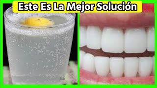 Quita el Sarro de Tus Dientes con 1 Remedio casero hecho por ti mismo [upl. by Robbie]