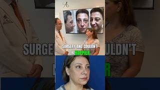 Long Term Results of A Female Middle Eastern Rhinoplasty [upl. by Theone]