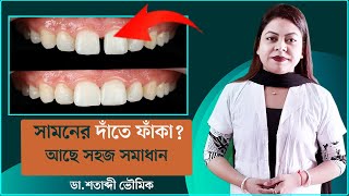 সামনের দাঁতে ফাঁকা  Gap Between Front teeth  Dr Shatabdi Bhowmik  Bangla [upl. by Marcile]