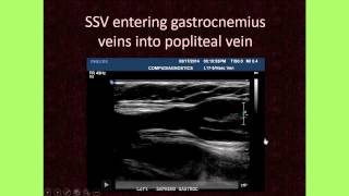 The Importance of Venous Anatomy for the Reflux Ultrasound Examination [upl. by Decca]