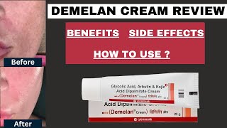 Demelan cream review Demelan cream How to use Glycolic acid Skin Brightening cream  Hindi [upl. by Sinnoda]