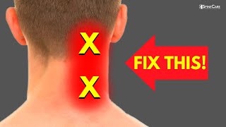 How to Fix Neck Pain off to the Side [upl. by Rayham]